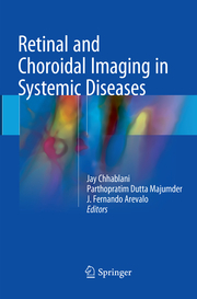 Retinal and Choroidal Imaging in Systemic Diseases