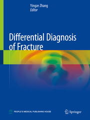 Differential Diagnosis of Fracture