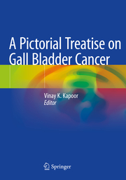 A Pictorial Treatise on Gall Bladder Cancer