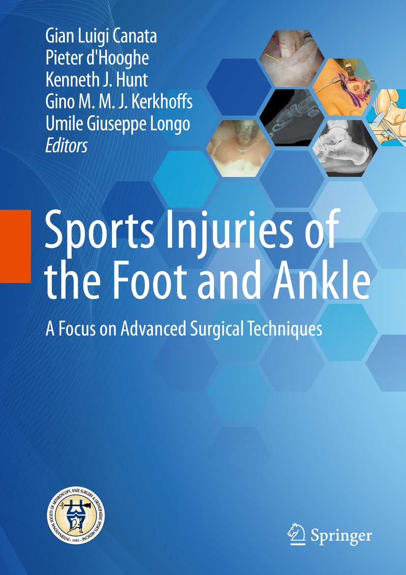 Sports　and　al　J　Ankle　the　Gino　of　M　von　Kerkhoffs/Gian　Injuries　et　Canata/Kenneth　Hunt　(E-Book,　PDF)　M　Foot　Luigi　J　Schönstatt-Verlag